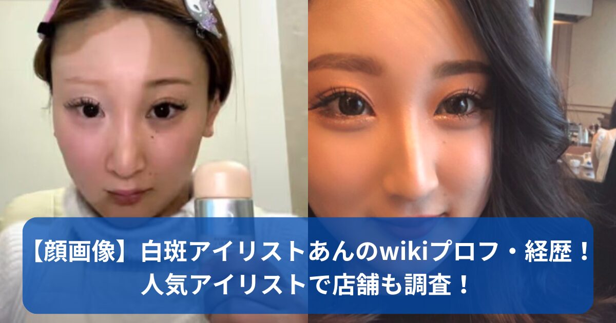 白斑アイリストあん　wikiプロフ・経歴